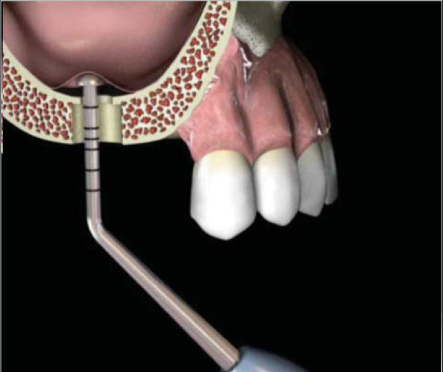 step4.JPG