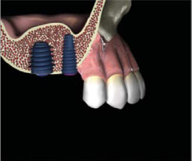 step8.JPG